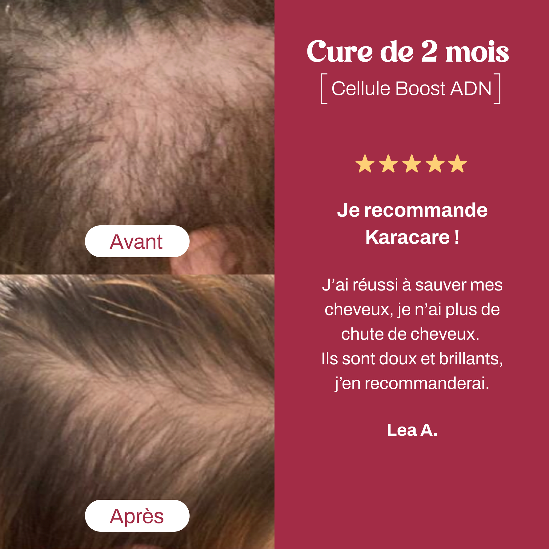 Cellule Boost