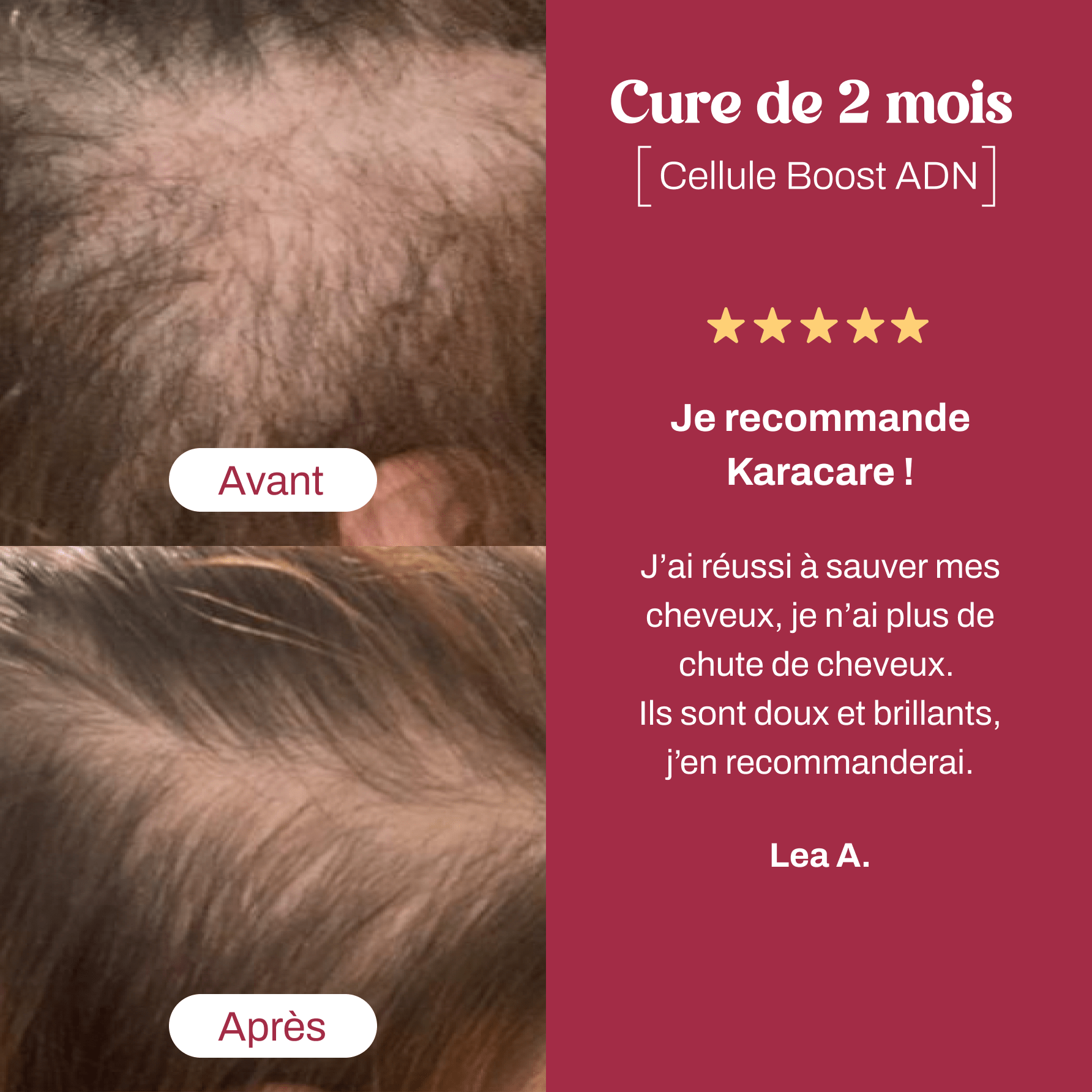 Cellule Boost - Karacare